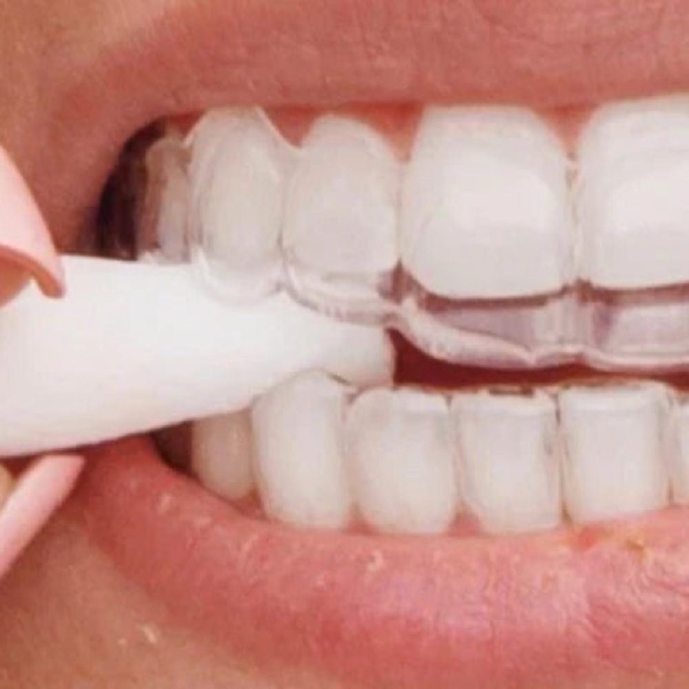 Chewies Aligner Tray Seaters white unscented for Invisalign